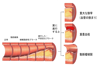 健康の話